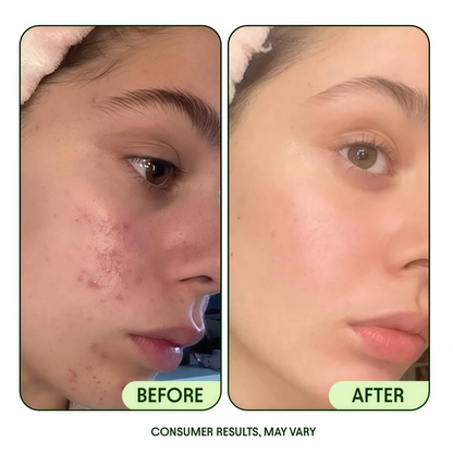 Renewal & Rejuvenation Toner Pads