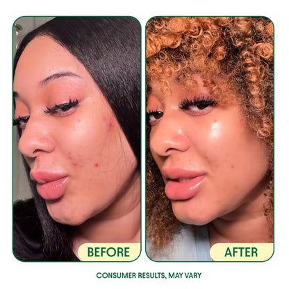 Anti-Aging Glow-Up Bundle