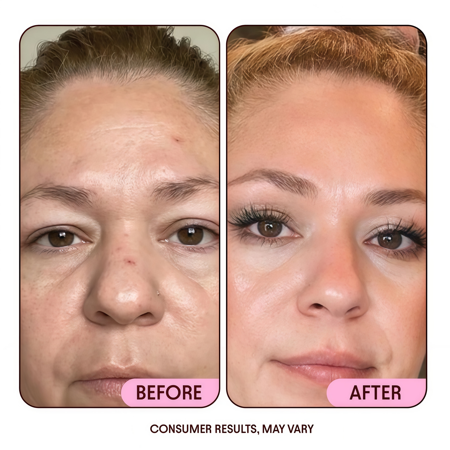 Anti-Aging Moisturizing Cream